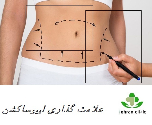 علامت گذاری