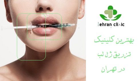 عوارض ژل لب