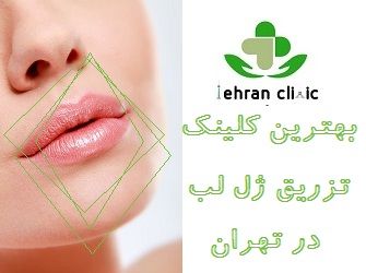 بهترین مرکز تزریق ژل لب در تهران
