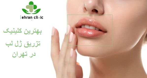 بهترین کلینیک تزریق ژل لب در تهران