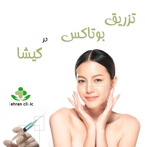 تزریق بوتاکس در گیشا