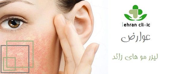 عوارض  لیزر مو های زائد