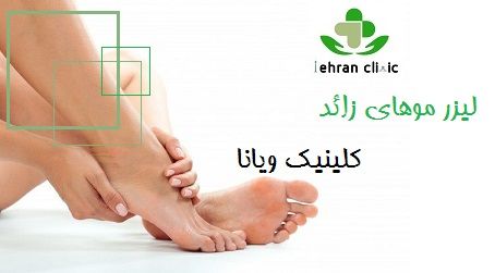 لیزر موهای زائد کلینیک ویانا 