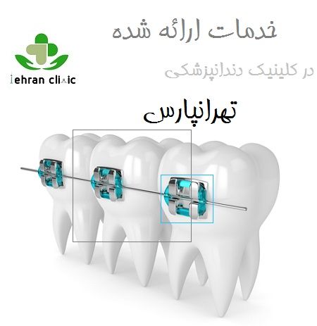 خدمات ارائه شده در کلینیک دندانپزشکی تهرانپارس