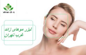 لیزر موهای زائد