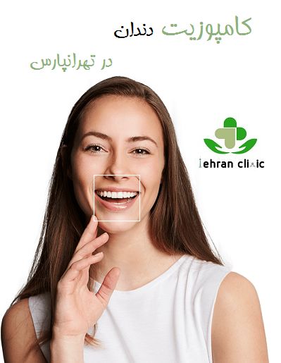 کامپوزیت دندان در تهرانپارس