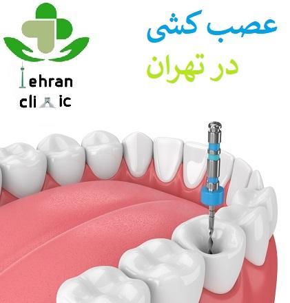 عصب کشی دندان در تهران