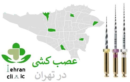 متخصص عصب کشی و ریشه دندان در تهران