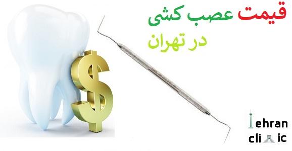هزینه عصب کشی دندان در تهران