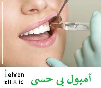 متخصص عصب کشی در تهران