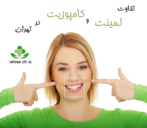 تفاوت لمینت و کامپوزیت در تهران