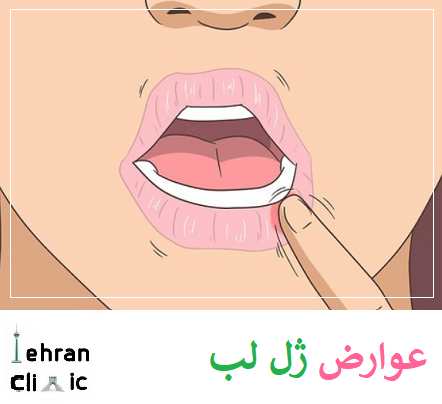 بی حسی لب ها از عوارض ژل لب