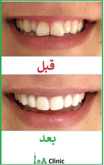 مرکز لمینت خوب در تهران 4