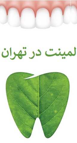 لمینت دندان چیست؟