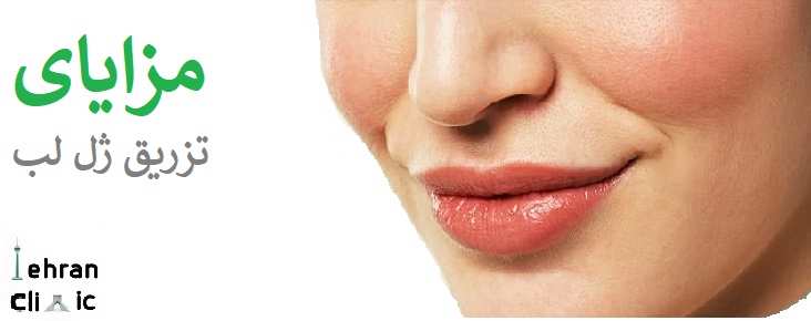 مزایا تزریق ژل لب
