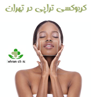 کربوکسی تراپی در تهران