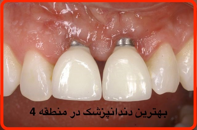 بهترین دندانپزشک در منطقه 4
