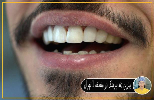 بهترین دندانپزشک در منطقه 1 تهران