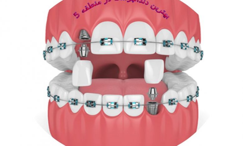 بهترین دندانپزشک در منطقه 5