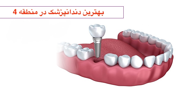 بهترین دندانپزشک در منطقه 4