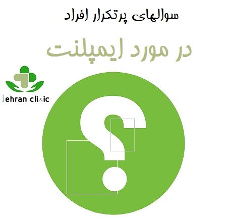 سوالهای پرتکرار افراد در مورد ایمپلنت