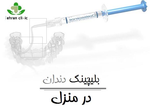 بلیچینگ دندان در منزل