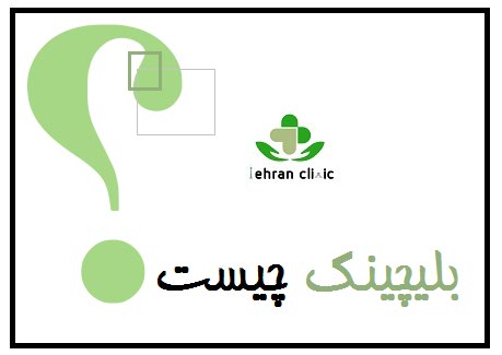 بلیچینگ چیست؟