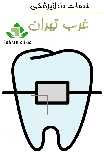 قیمت خدمات دندانپزشکی غرب تهران