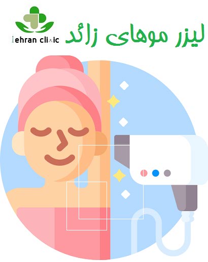لیزر موهای زائد