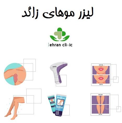 لیزر موهای زائد