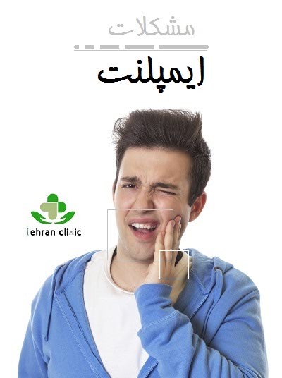 مشکلات ایمپلنت