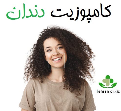 کامپوزیت دندان