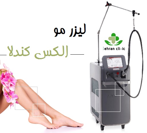 دستگاه الکس کندلا برای لیزر موهای زائد