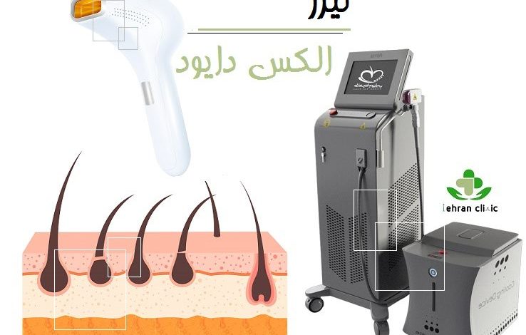 لیزر الکس دایود
