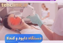 مراکز لیزر مو شرق تهران