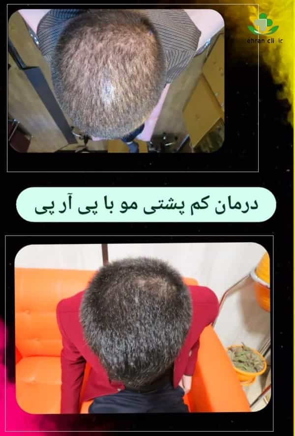 پی ار پی کلینک بهشت
