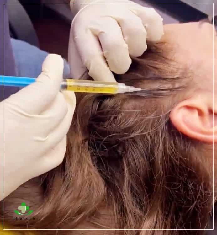 پی ار پی در کلینیک دلدار، غرب تهران