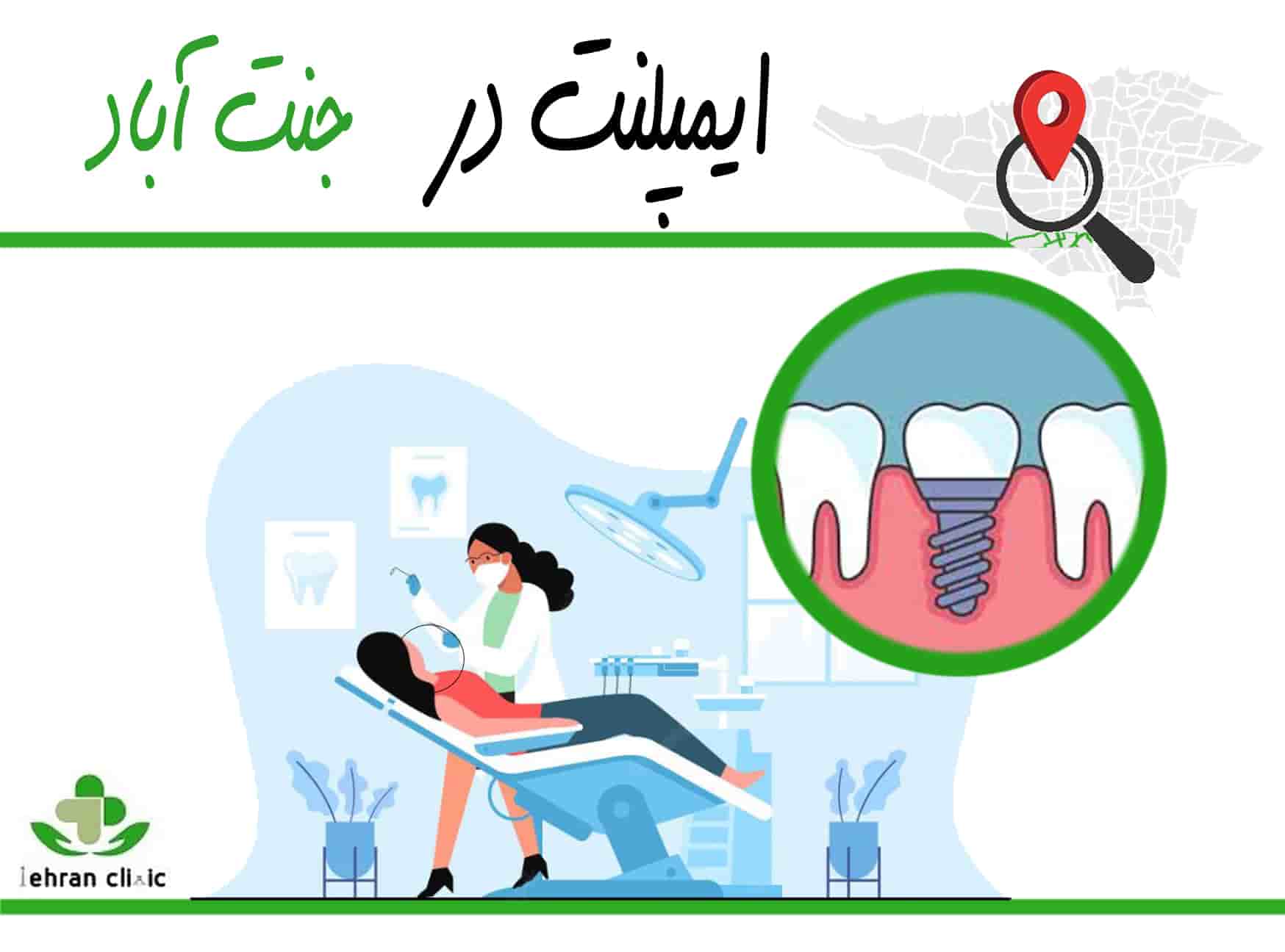 ایمپلنت در جنت آباد1
