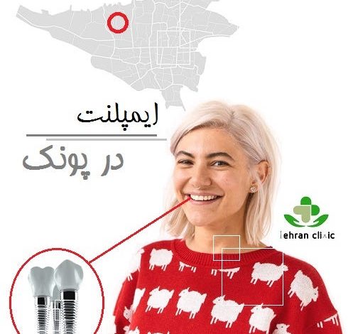 ایمپلنت در پونک