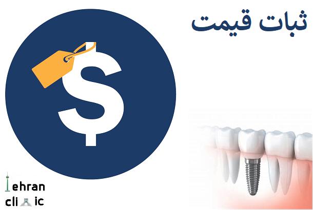ثبات قیمت ایمپلنت