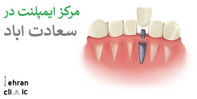 مرکز ایمپلنت سعادت اباد