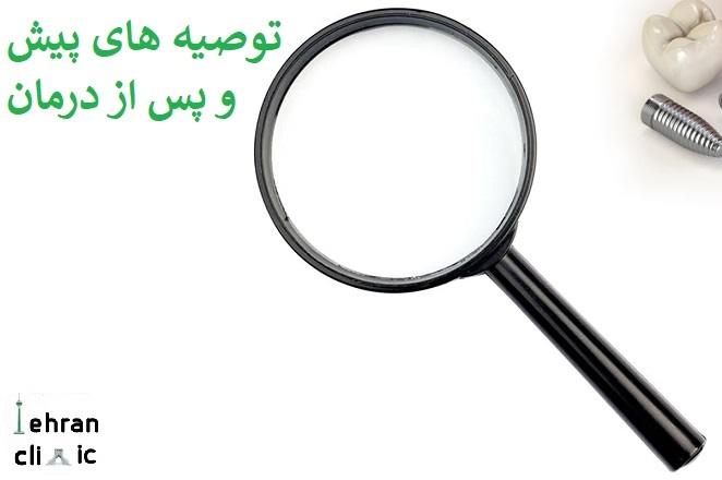 توصیه های پیش و پس از درمان برای مراجعه به بهترین مرکز ایمپلنت سعادت اباد 