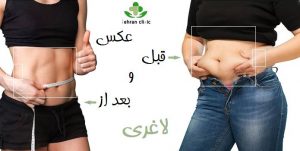 عکس قبل و بعد از لاغری