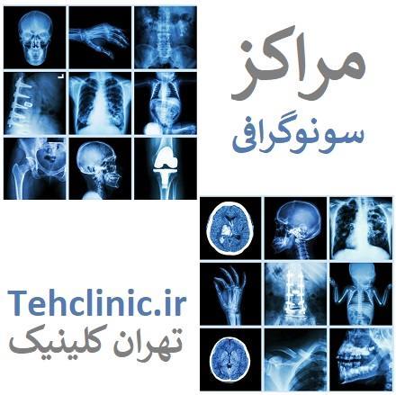 سونو گرافی مراکز