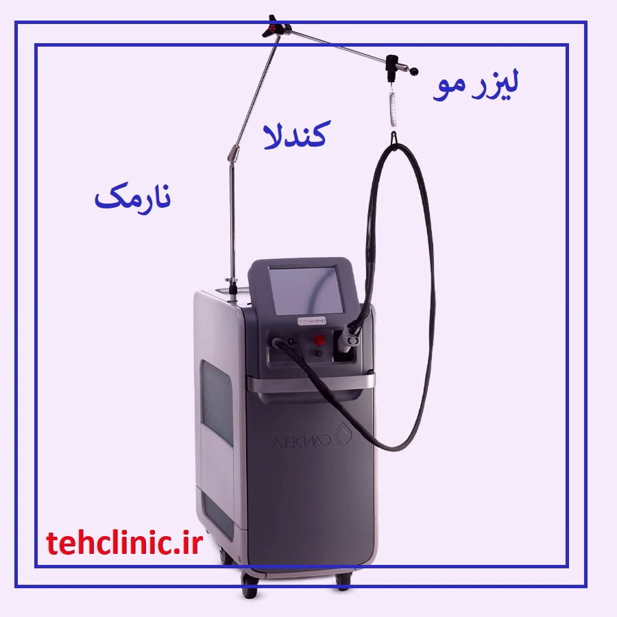 مرکز لیزر مو کندلا