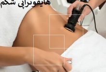 هایفوتراپی شکم