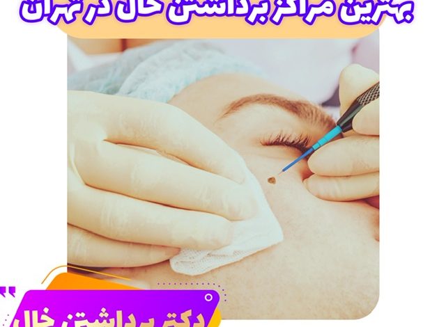 از بین رفتن خال در تهران