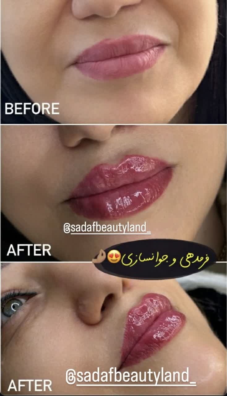 نمونه کارهای کلینیک زیبایی بیوتی لند