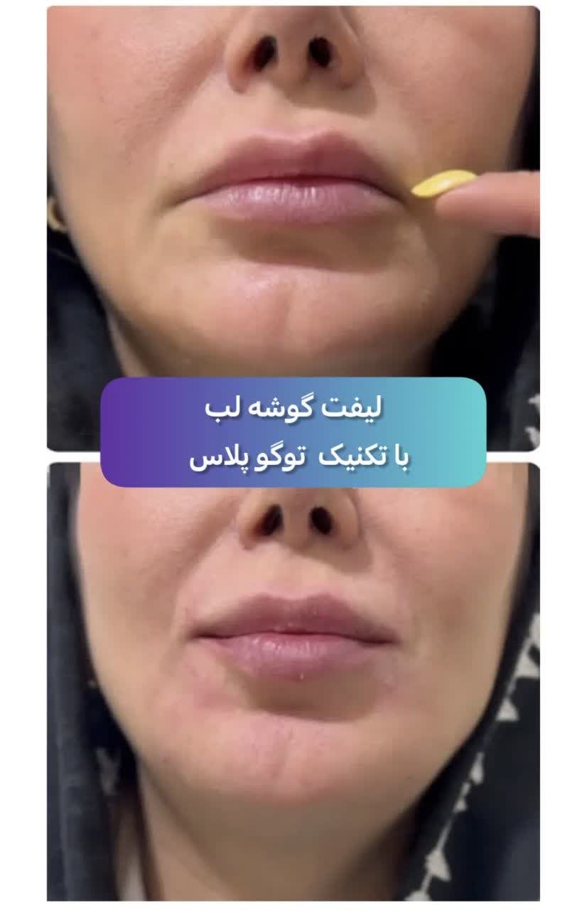 نمونه کارهای کلینیک زیبایی بیوتی لند