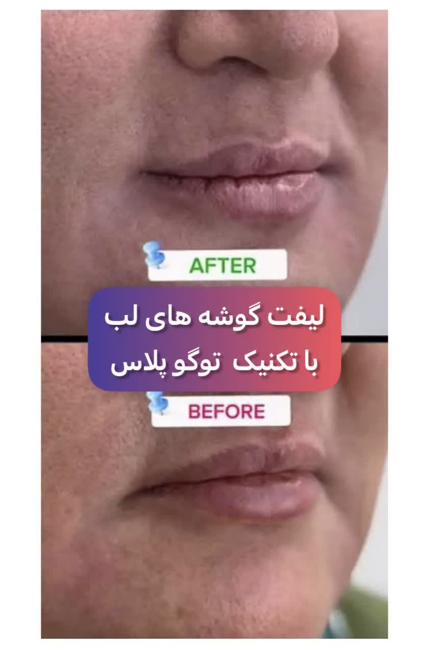 نمونه کارهای کلینیک زیبایی بیوتی لند